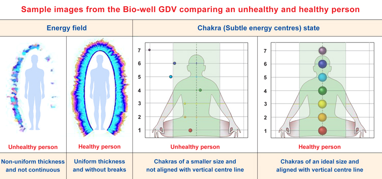 Sample images from Bio-well GDV of an unhealth and healthy person